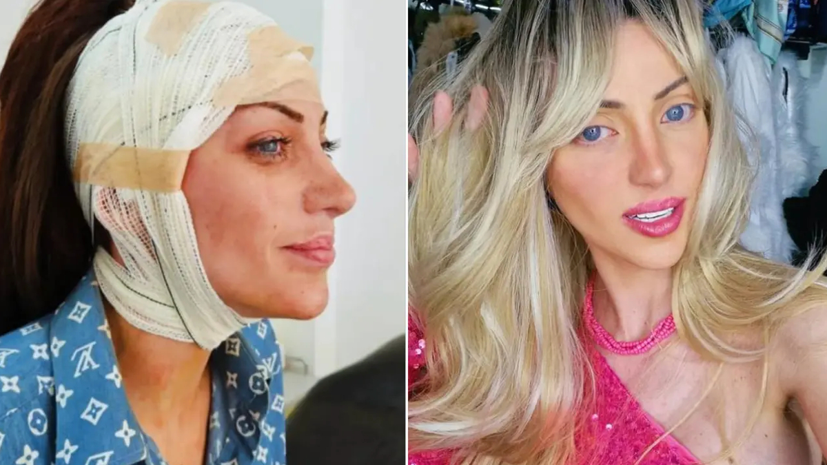barbie bebege benzemek icin 27 kez ameliyat oldu brezilyali fenomen 31 yasinda hayatini kaybetti CtvAzTqv.jpg
